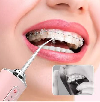 Irrigador dental profesional (colores variado)