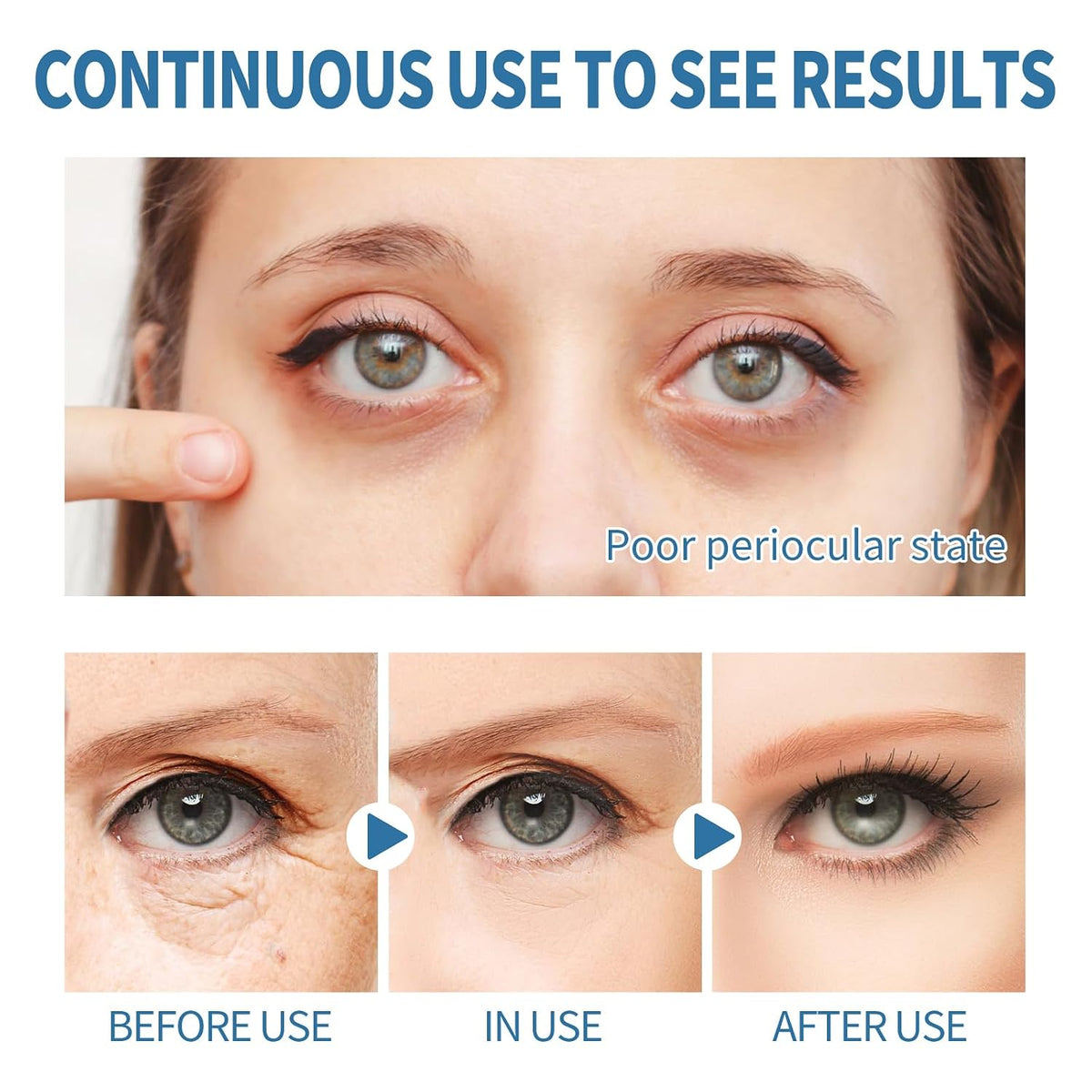 Parches para Ojos