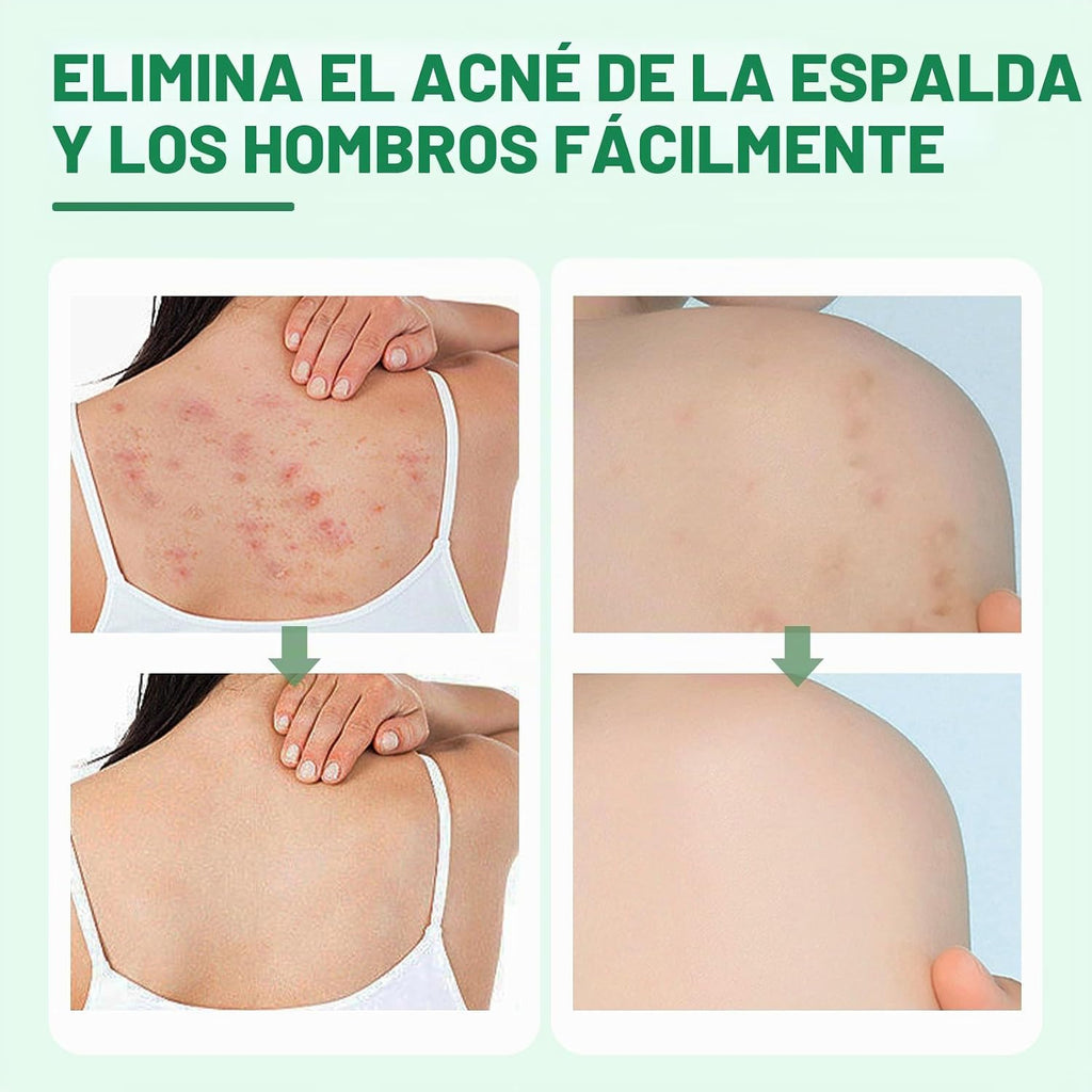 Spray de granos para el cuerpo