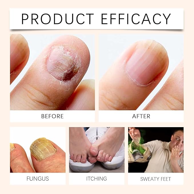 Spray reparador de uñas con veneno de abeja