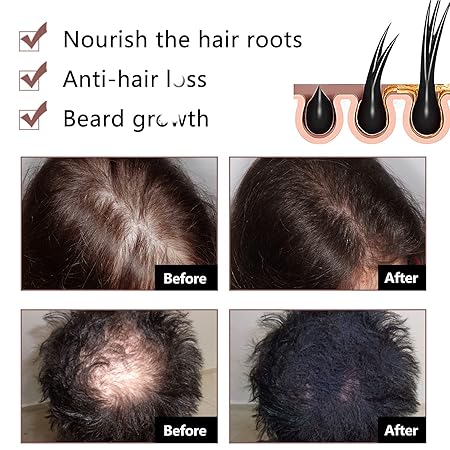 Jabón de cabello con ginseng