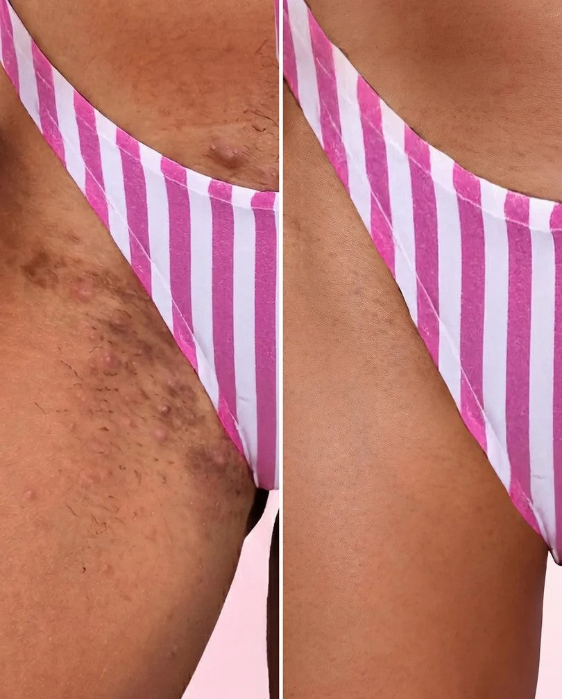 Bella Skin 3 en 1 – Loción Corporal Hidratante y Aclarante